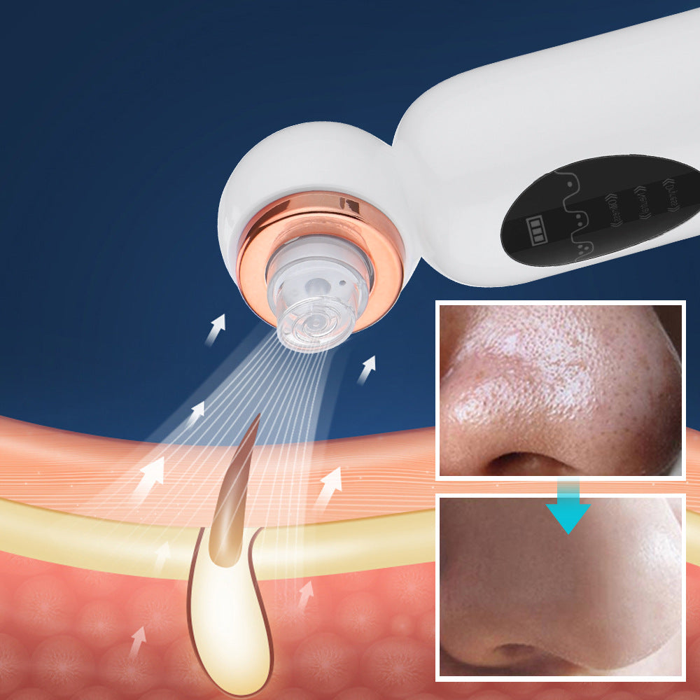 3-Speed Small Bubble Blackhead Instrument Facial Pore Cleaning Blackhead Removal