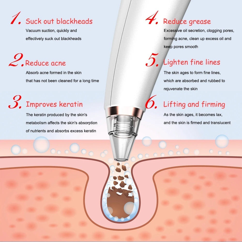 Rechargeable Facial Pore Cleanser